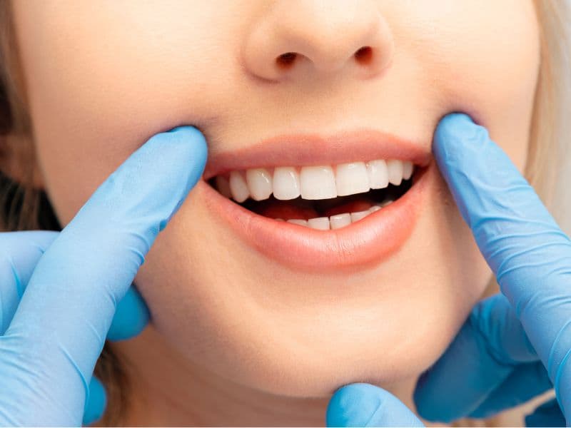 Dental Procedures